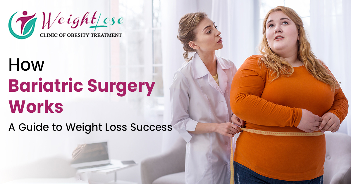 How Bariatric surgery works | Weightlose Clinic Delhi